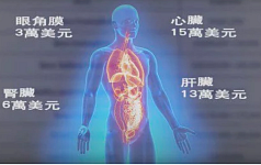 一场“追尾”引发出的一串“追问”（图）